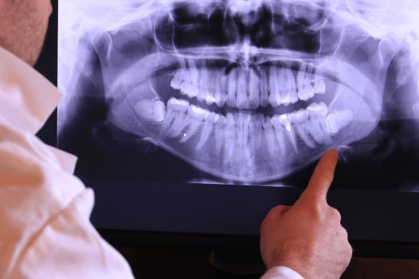 Best Emergency TMJ Treatment in Crest, CA