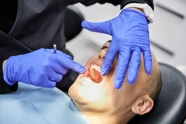 Best Emergency Dental Care for Broken or Chipped Teeth in Crest, CA